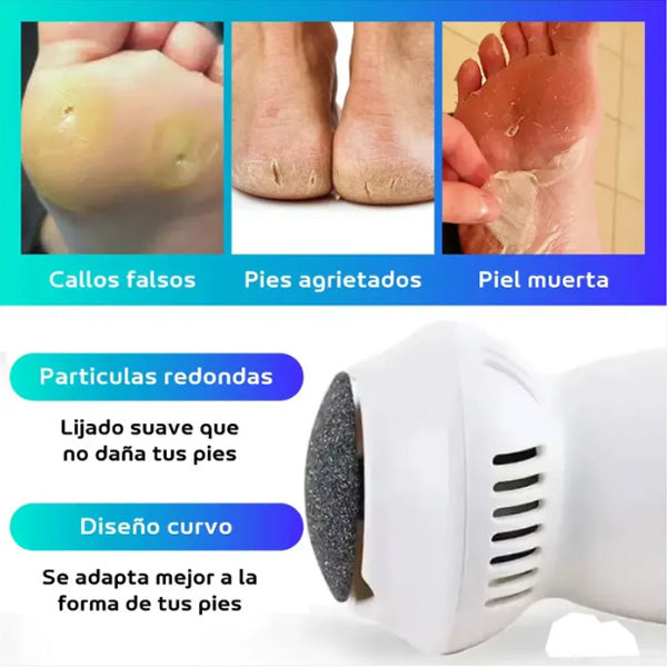 Removedor de callos eléctrico